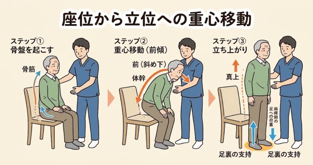 片麻痺の立ち上がり訓練